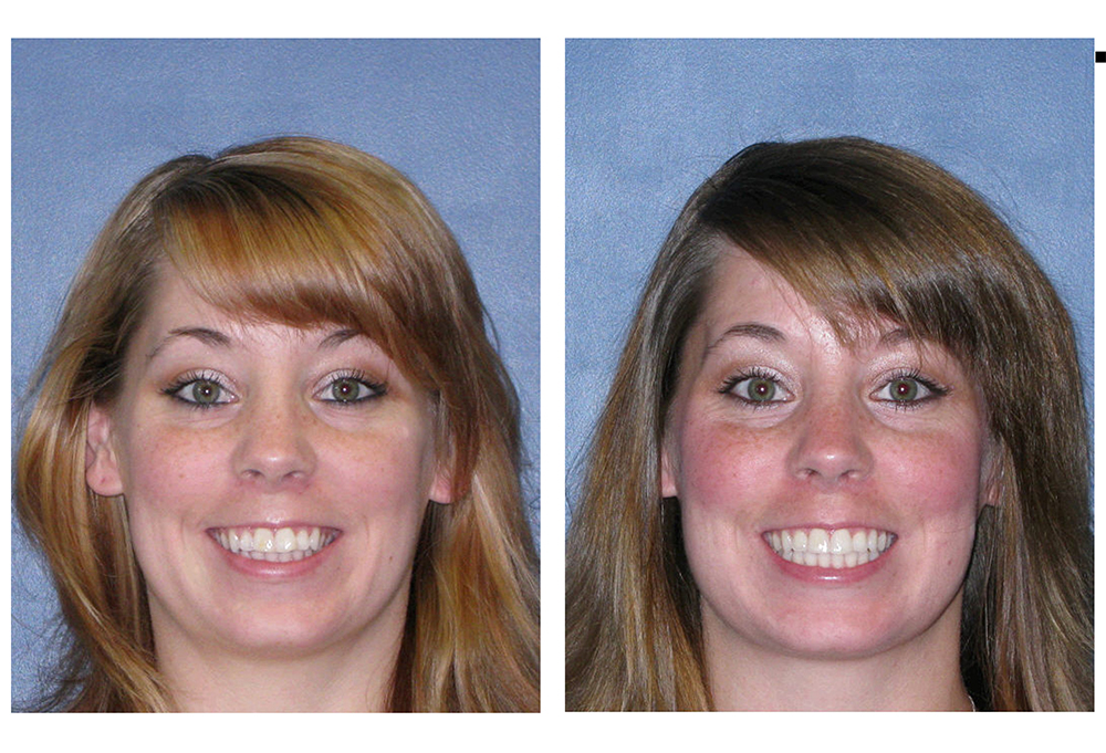 White Marsh Smiles Dental Office