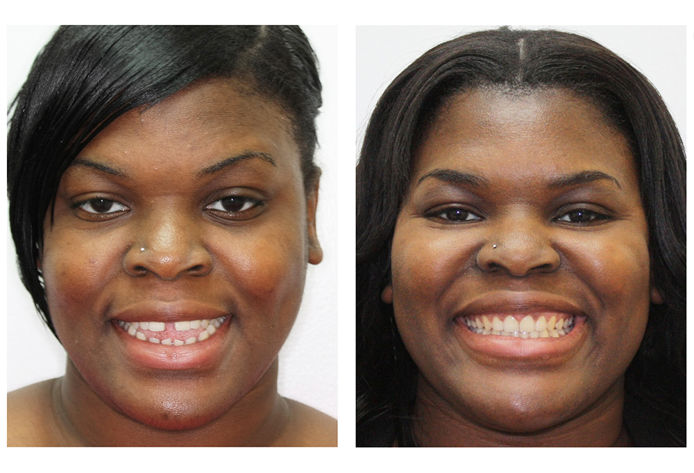 White Marsh Smiles Dental Office