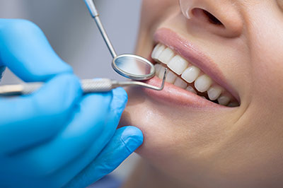 Dental Checkups in White Marsh