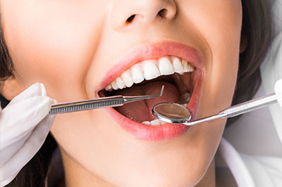 Periodontal Surgery in White Marsh