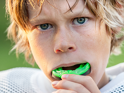 Sports Mouthguards in White Marsh